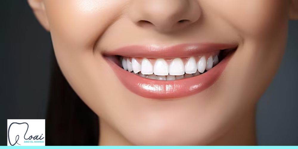 هل تناسبك ابتسامة هوليوود